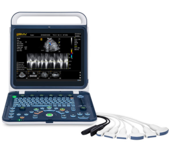 Powerful Advanced Functions Portable Color Doppler Ultrasound