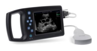Hand held Ultrasound Scanner A6